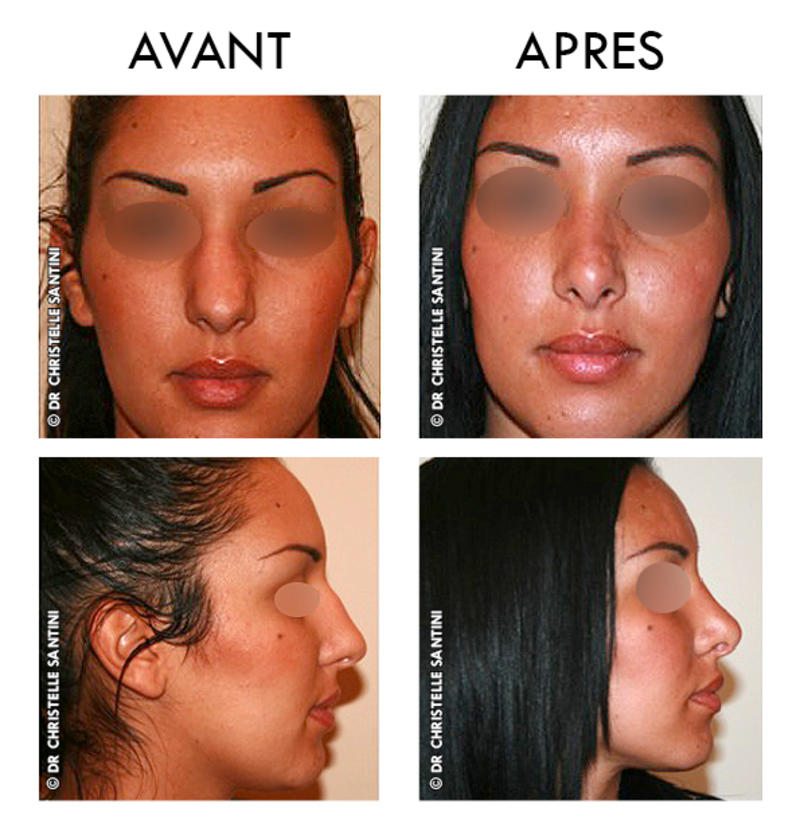 Docteur Santini Chirurgien esthétique Paris