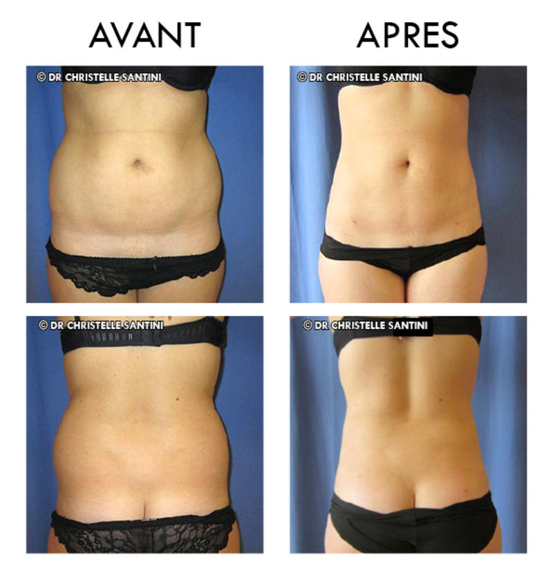 Docteur Santini Chirurgien esthétique Paris