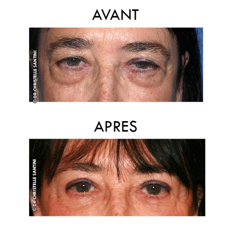 Docteur Santini Chirurgien esthétique Paris