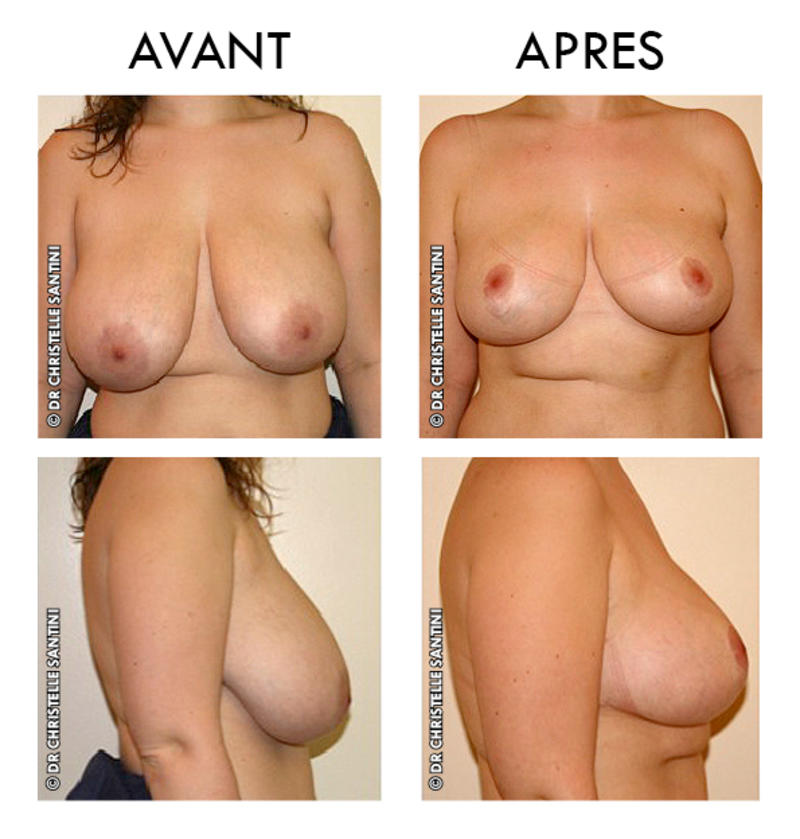 Docteur Santini Chirurgien esthétique Paris