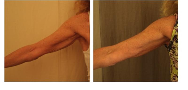 Docteur Santini Chirurgien esthétique Paris